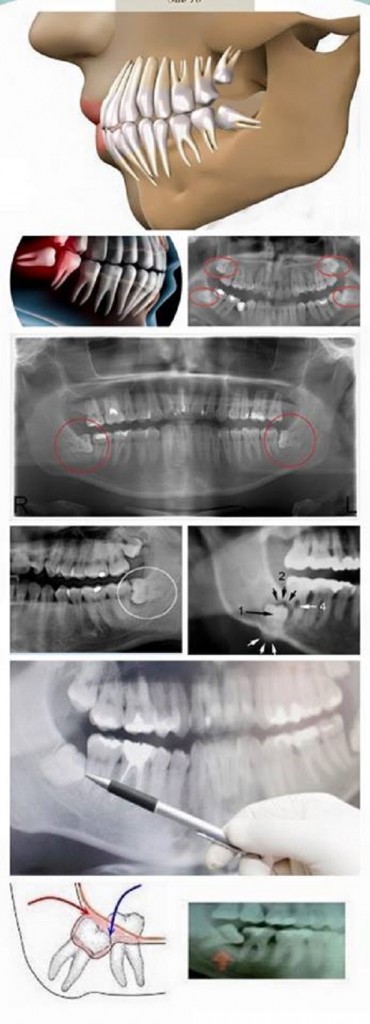 φρονιμήτες 370x1024