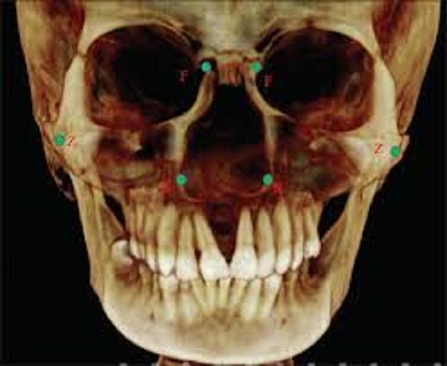 προγομφιοι 1