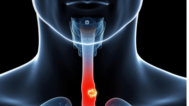 21dc17a6 767b 11e7 84d9 Df29f06febc3 1280x720 140011 1