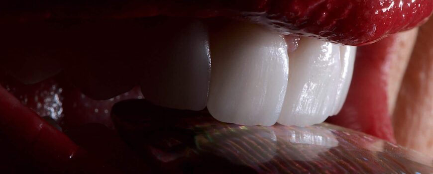 Τι είναι η οδοντική στεφάνη από ζιρκόνιο;