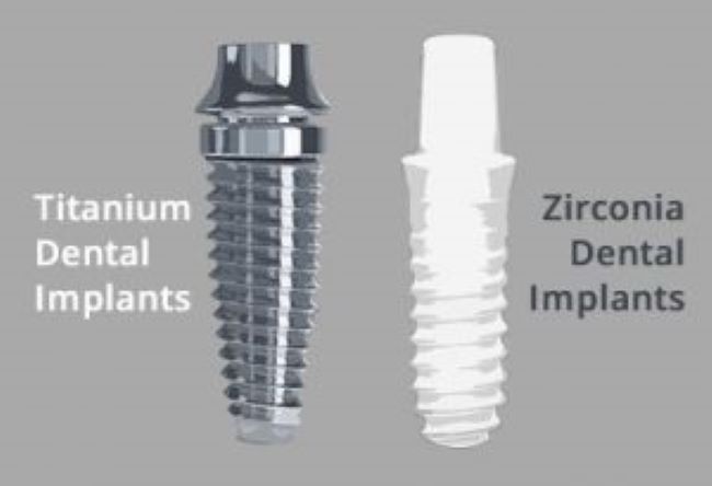 Implantes Dentales Titanio Zirconio